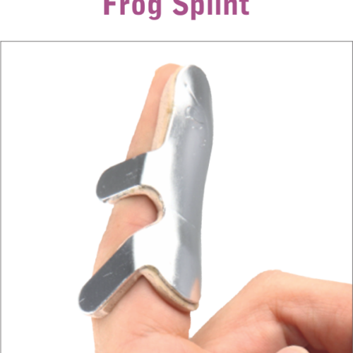 Frog Splint OC-2097